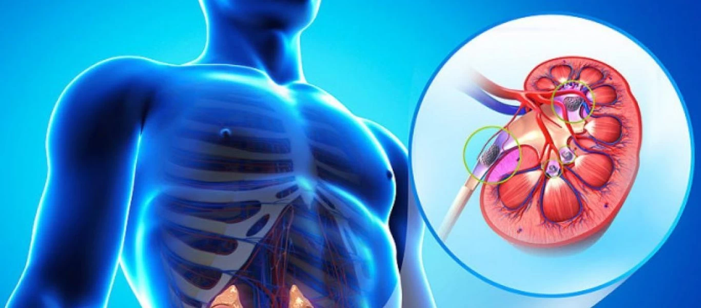 Κολικός νεφρού: Πώς θα απαλλαγείτε φυσικά από τους πόνους;